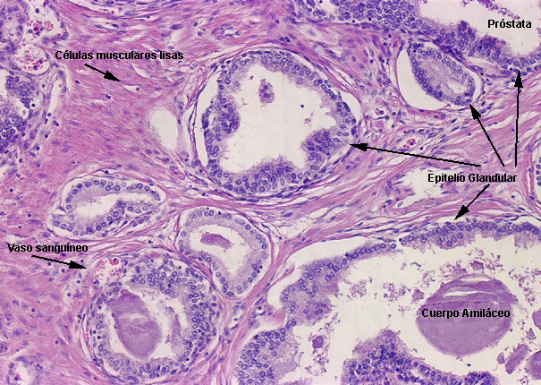 celulas de la prostata histologia